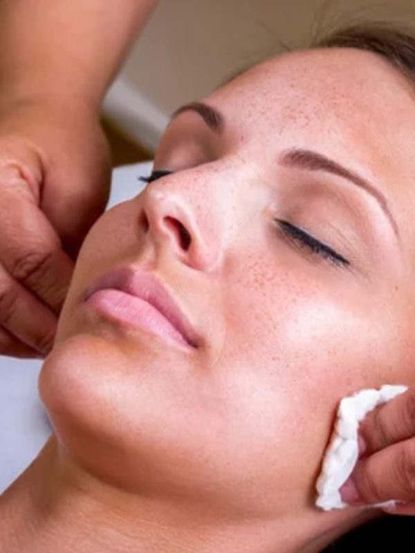 Facial Peels at Renew Skin Care Center